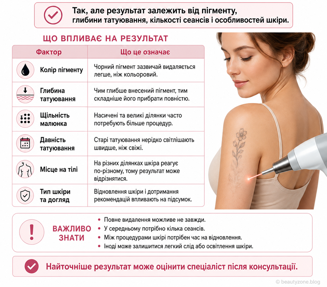 Інфографіка на білому фоні про те, чи можна повністю видалити жіноче татуювання, з таблицею факторів, що впливають на результат, і зображенням лазерного видалення татуювання на плечі жінки.