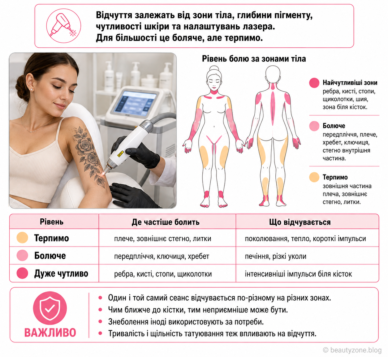 Інфографіка на білому фоні про те, чи боляче видаляти татуювання, з жінкою під час лазерної процедури, картою зон тіла за рівнем болю, таблицею відчуттів і поясненнями, де боляче, а де терпимо.
