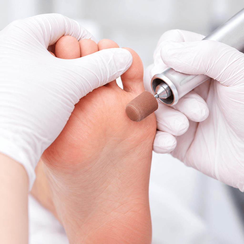 Professional foot treatment with an electric rotary tool during a pedicure.